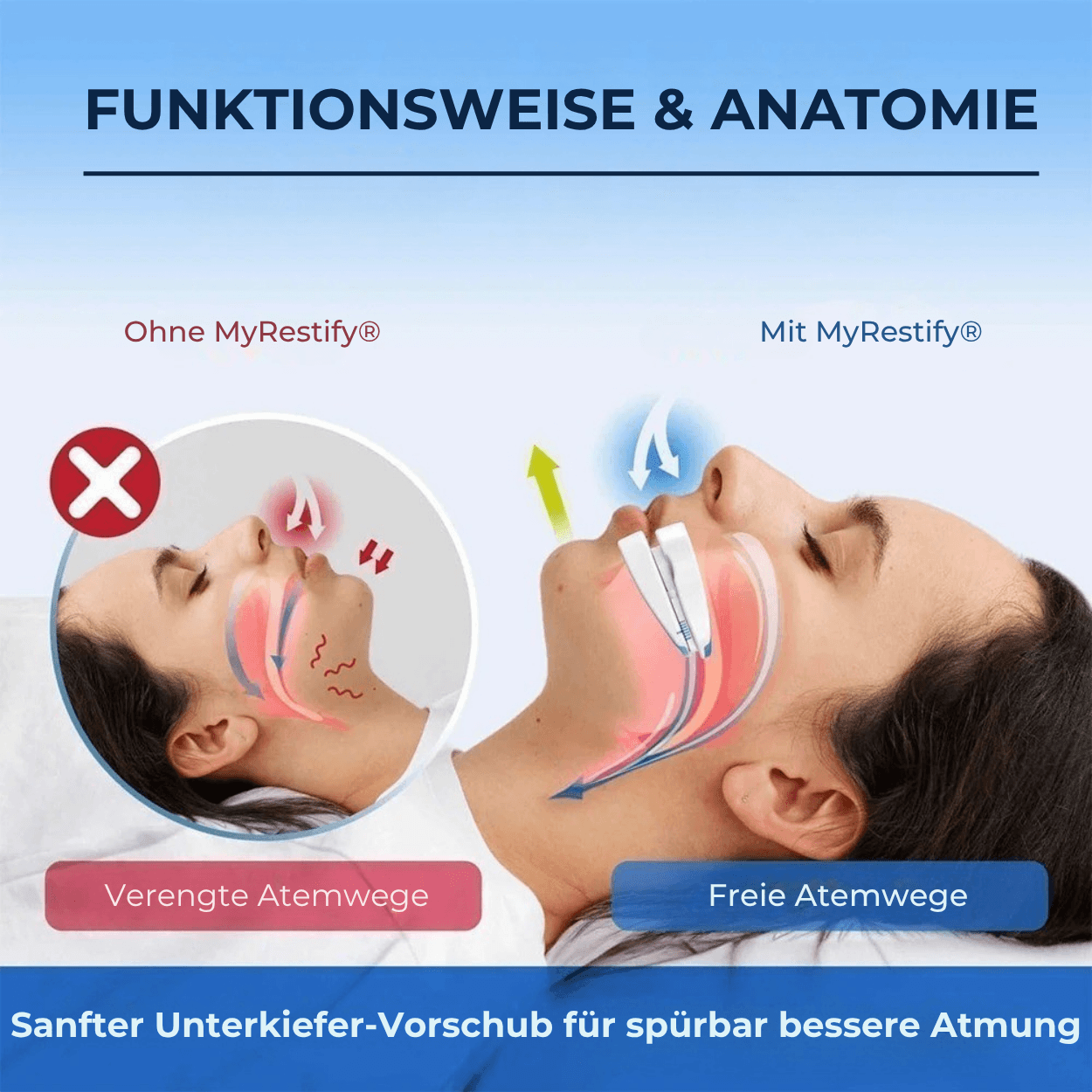 MyRestify® Ultimate Recovery Set